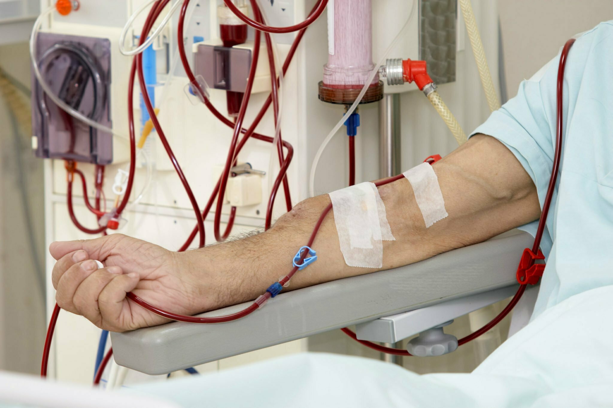 dialysis tech jobs utah